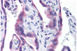 Human Placenta: Formalin-Fixed, Paraffin-Embedded (FFPE) (STT3A antibody  (AA 603-702))