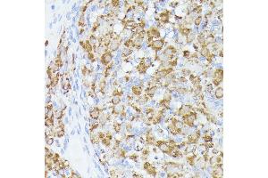 Immunohistochemistry of paraffin-embedded rat ovary using  antibody (ABIN6131166, ABIN6136417, ABIN6136418 and ABIN6223845) at dilution of 1:100 (40x lens). (ACAT2 antibody  (AA 1-97))
