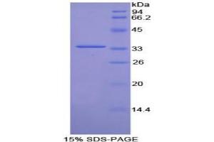 SDS-PAGE analysis of Rat Torsin 3A Protein. (TOR3A Protein)