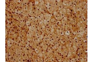 IHC image of ABIN7142226 diluted at 1:600 and staining in paraffin-embedded human adrenal gland tissue performed on a Leica BondTM system. (PSMC6 antibody  (Regulatory Subunit 10B))