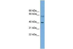 WB Suggested Anti-PRKACA Antibody Titration: 0. (PRKACA antibody  (N-Term))
