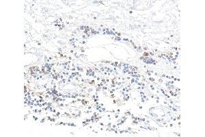 Immunohistochemistry (IHC) image for anti-CD96 (CD96) (AA 29-502) antibody (ABIN7455093) (Recombinant CD96 antibody  (AA 29-502))