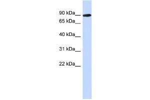 WB Suggested Anti-PGM2L1 Antibody Titration: 0. (PGM2L1 antibody  (N-Term))
