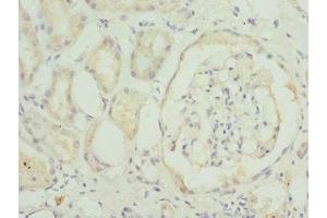Immunohistochemistry of paraffin-embedded human kidney tissue using ABIN7172352 at dilution of 1:100 (TRAPPC1 antibody  (AA 1-260))