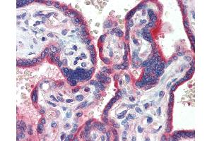 Anti-ZNF165 antibody IHC of human placenta.