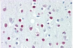 Anti-WHSC1 / NSD2 antibody IHC staining of human brain, cortex. (WHSC1 antibody  (AA 219-268))