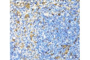 Immunohistochemistry of paraffin-embedded Mouse spleen using CD27 Polyclonal Antibody at dilution of 1:100 (40x lens). (CD27 antibody)