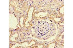 Immunohistochemistry of paraffin-embedded human kidney tissue using ABIN7169234 at dilution of 1:100 (WNK4 antibody  (AA 828-1106))