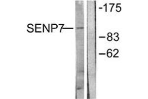 Western blot analysis of extracts from HuvEc cells, using SENP7 Antibody. (SENP7 antibody  (AA 991-1040))
