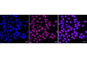 Immunocytochemical staining of HepG2 cells with Histone H2B (acetyl K16) antibody (ABIN7798943), 1:1,000). (Recombinant Histone H2B antibody  (H2BK16ac))
