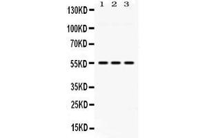 Western blot analysis of MPP1 expression in rat lung extract ( Lane 1), mouse spleen extract ( Lane 2) and MCF-7 whole cell lysates ( Lane 3). (MPP1 antibody  (C-Term))