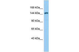 Host:  Rabbit  Target Name:  Corin  Sample Type:  Mouse Testis lysates  Antibody Dilution:  1. (Corin antibody  (C-Term))