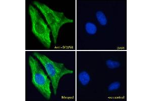 ABIN6391376 Immunofluorescence analysis of paraformaldehyde fixed HeLa cells, permeabilized with 0. (DDX58 antibody  (C-Term))