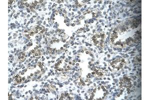 Human Lung; . (SUPT5H antibody  (C-Term))