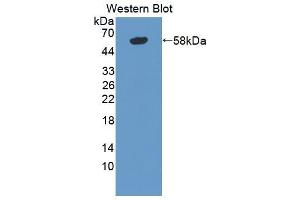 Western blot analysis of the recombinant protein. (TNXB antibody  (AA 3835-4088))