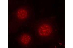 Immunofluorescence (IF) image for anti-Forkhead Box O4 (FOXO4) (pSer197) antibody (ABIN1870198) (FOXO4 antibody  (pSer197))