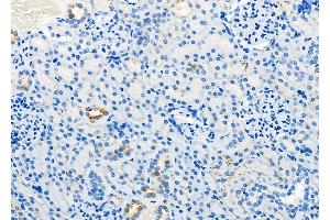 ABIN6260006 and ABIN6279136 at 1/100 staining Rat kidney tissue by IHC-P.