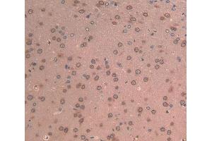 IHC-P analysis of brain tissue, with DAB staining. (LAMB2 antibody  (AA 75-223))