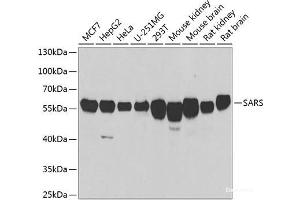 Western blot analysis of extracts of various cell lines using SARS Polyclonal Antibody at dilution of 1:1000. (Seryl-tRNA Synthetase (SARS) antibody)