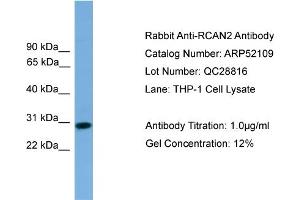 WB Suggested Anti-RCAN2  Antibody Titration: 0. (RCAN2 antibody  (Middle Region))