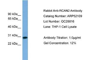 WB Suggested Anti-RCAN2  Antibody Titration: 0.