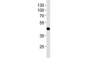 Western Blotting (WB) image for anti-Absent in Melanoma 2 (AIM2) (AA 10-40) antibody (ABIN3028441)