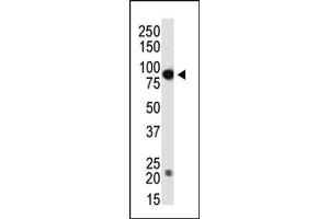 Image no. 1 for anti-DNA (Cytosine-5-)-Methyltransferase 3 beta (DNMT3B) (Middle Region) antibody (ABIN356569) (DNMT3B antibody  (Middle Region))