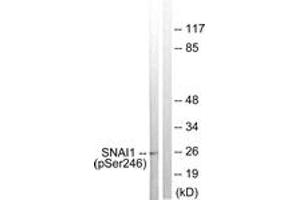Western blot analysis of extracts from HT29 cells, using SNAI1 (Phospho-Ser246) Antibody. (SNAIL antibody  (pSer246))