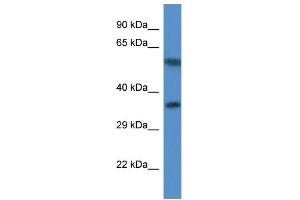 Western Blot showing MRPL45 antibody used at a concentration of 1. (MRPL45 antibody  (C-Term))