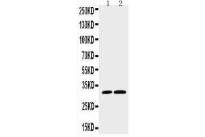 Anti-Caspase-3(P10),  Western blotting Lane 1: HELA Cell Lysate Lane 2: SMMC Cell Lysate (Caspase 3 antibody  (C-Term))