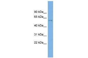 WB Suggested Anti-KIAA1430 Antibody Titration: 0. (CFAP97/KIAA1430 antibody  (Middle Region))