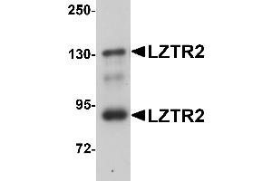 Western Blotting (WB) image for anti-SEC16 Homolog B (SEC16B) (C-Term) antibody (ABIN1030501) (SEC16B antibody  (C-Term))