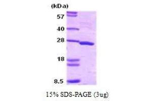 Figure annotation denotes ug of protein loaded and % gel used. (SNAP25 Protein (AA 1-206))