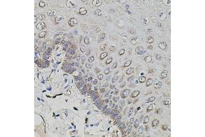 Immunohistochemistry of paraffin-embedded human esophagus using APP antibody. (beta Amyloid antibody)