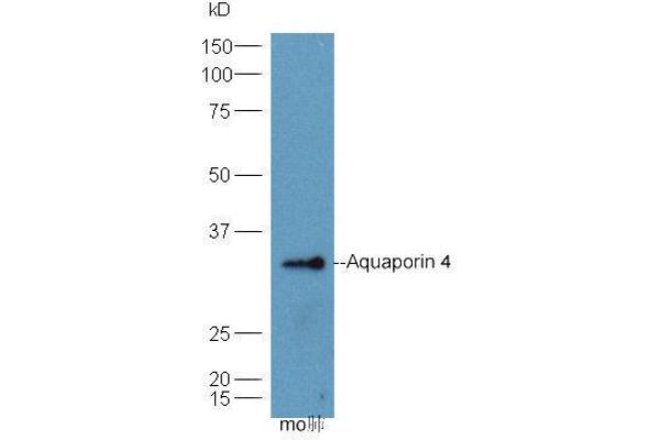Aquaporin 4 anticorps  (AA 271-323)