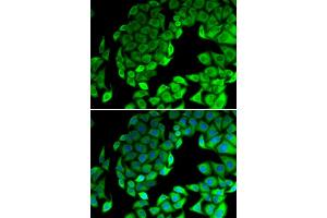 Immunofluorescence analysis of MCF-7 cells using RPL14 antibody (ABIN6291381).