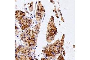 Immunohistochemical analysis of NUDT15 staining in human stomach formalin fixed paraffin embedded tissue section. (NUDT15 antibody)