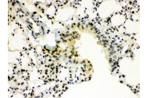 Immunohistochemistry (Paraffin-embedded Sections) (IHC (p)) image for anti-Sp3 Transcription Factor (Sp3) (AA 569-599), (C-Term) antibody (ABIN3043350) (Sp3 antibody  (C-Term))