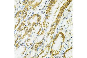 Immunohistochemistry of paraffin-embedded human esophagus using HLA-DQA1 antibody (ABIN5971195) at dilution of 1/100 (40x lens). (HLA-DQA1 antibody)
