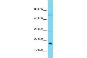 Host:  Rabbit  Target Name:  BLOC1S1  Sample Type:  Lung Tumor lysates  Antibody Dilution:  1. (BLOC1S1 antibody  (N-Term))