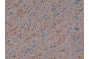 Detection of DBP in Human Cerebrum Tissue using Polyclonal Antibody to Vitamin D Binding Protein (DBP) (Vitamin D-Binding Protein antibody  (AA 209-401))