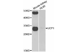 Western blot analysis of extracts of various cell lines, using UCP1 antibody (ABIN2560658) at 1:1000 dilution. (UCP1 antibody)
