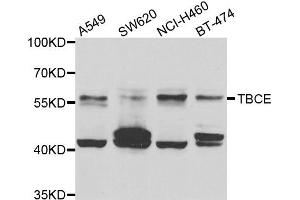 Western blot analysis of extracts of various cell lines, using TBCE antibody. (TBCE antibody)