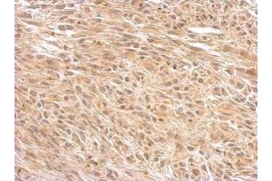 IHC-P Image O-GlcNAc transferase antibody [N1N2], N-term detects OGT protein at cytosol on U373 xenograft by immunohistochemical analysis. (OGT antibody  (N-Term))