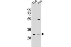 Western Blotting (WB) image for anti-Olfactory Receptor, Family 5, Subfamily L, Member 2 (OR5L2) antibody (ABIN2995999) (OR5L2 antibody)