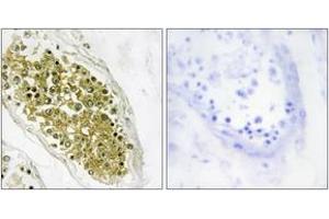 Immunohistochemistry analysis of paraffin-embedded human testis tissue, using HIPK4 Antibody. (HIPK4 antibody  (AA 511-560))