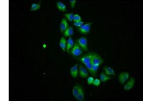 Immunofluorescence staining of Hela cells with ABIN7170075 at 1:100, counter-stained with DAPI. (SLC12A3 antibody  (AA 791-952))