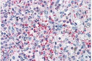 Human Spleen: Formalin-Fixed, Paraffin-Embedded (FFPE) (Pleckstrin antibody  (AA 121-231))