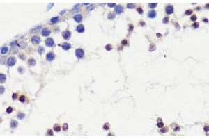 Immunohistochemistry of paraffin-embedded Mouse testis using HFM1 Polyclonal Antibody at dilution of 1:100 (40x lens). (HFM1 antibody)