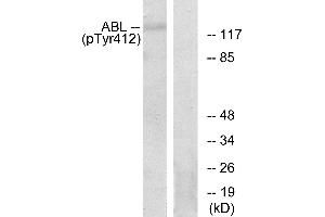 Immunohistochemistry analysis of paraffin-embedded human brain tissue using Abl (Phospho-Tyr393/412) antibody.